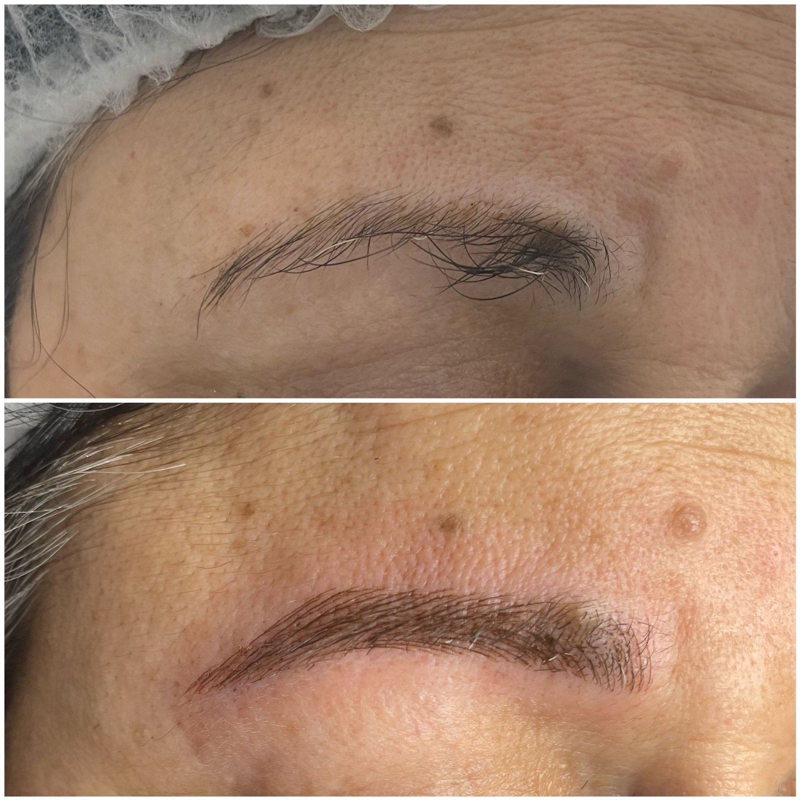 Tratamiento Estética 2